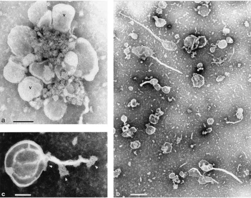 FIG. 1. (a) Rosette of virus-induced vesicles (V) surrounding a granular structure (RC) containing the replicating viral RNA, thus representing the actualreplication complex
