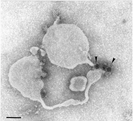FIG. 2. IEM of single vesicles obtained by dissociation of rosettes in the cold. All caps were found to be labeled with MAb against 2C (a) and 2B (b), but only asubpopulation was labeled with MAb VP1, recognizing the 14S pentamer conﬁguration (c)