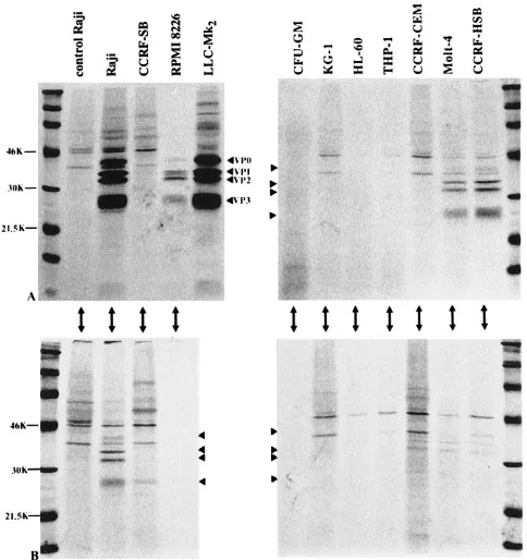 TABLE 1. Summary of the susceptibility of CFU-GM andhematopoietic cell lines to CBV3 infection by different methods