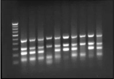 Fig. 1. The electrophoresis of group A amplified STS markers PCR products with Y-chromosome microdeletions using multiplex PCR reaction