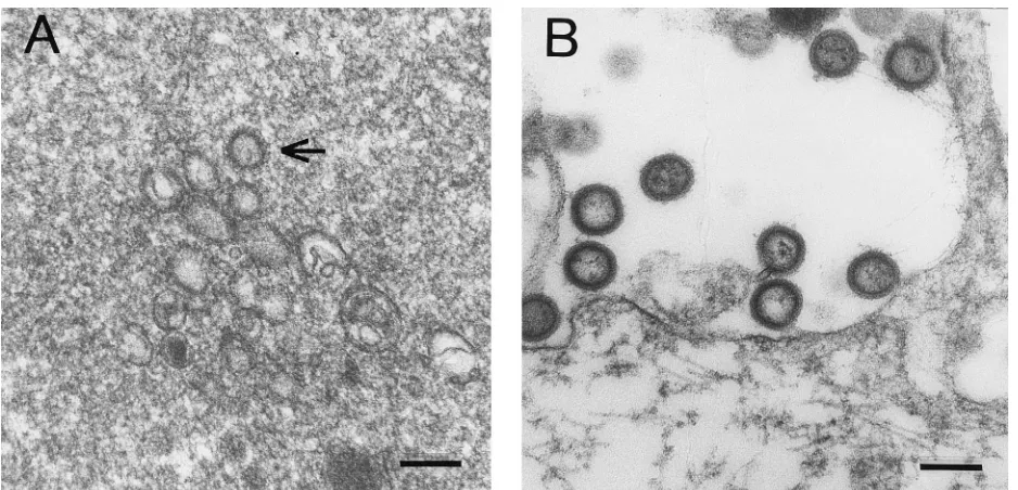 FIG. 7. Transmission electron microscopy of immature capsids. (A) Structures produced by reticulocyte lysate programmed with p55G1