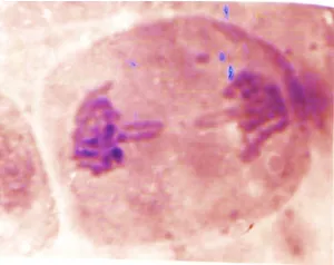 Fig. 1. Showing Normal Prophase