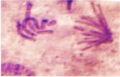 Fig. 1. Showing Sticky Chromatids at Prophase