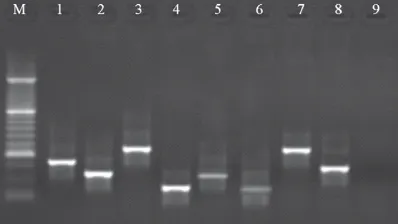 Fig. 3: Results of the gel electrophoresis foridentification of enterotoxigenic genes in S.aureus strains