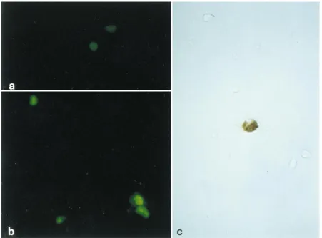 FIG. 3. Primary human tonsillar B lymphocytes infected in vitro with JCV. Immunoﬂuorescence analysis was performed to detect T (a) and V (b) viral proteins.Five days postinfection, JCV-positive B lymphocytes were detected by in situ hybridization (c) with 