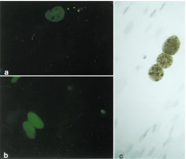 FIG. 4. In vitro infection of human tonsillar stromal cells. (a) Representative ﬁeld of viral T-antigen-positive cells; (b) representative ﬁeld of viral V-antigen-positivecells