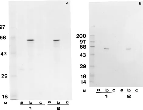 FIG. 1. Construction of MV insertion vectors (see Materials and Methods for details). TKL, left part of the vaccinia virus TK gene; TKR, right part of the VV TKgene; TKmL, left part of the MV (SG33 strain) TK gene; TKmR, right part of the MV (SG33 strain) 
