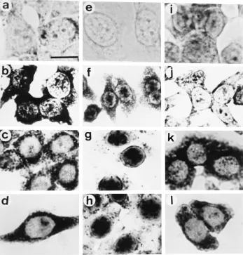 FIG. 1. Intron-containing transcripts are retained in the nucleus. Uninfected HeLa cells (a) and HeLa cells infected with wild-type HSV-1 for 2 h (b), 8 h (c), and16 h (d) were labelled with an antisense riboprobe against IE63, and the hybridized probe was visualized by immunolabelling and alkaline phosphatase color