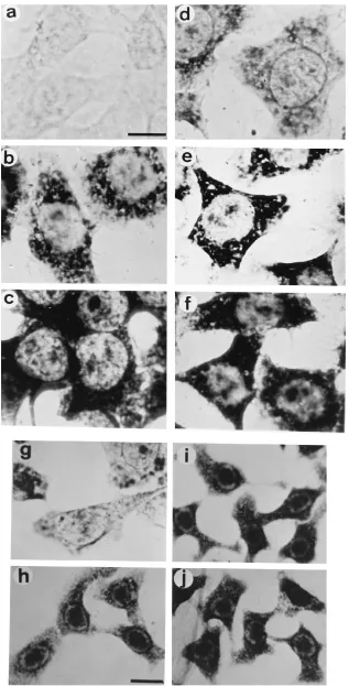 FIG. 2. Intronless transcripts are rapidly exported to the cytoplasm. Mock-infected HeLa cells (a and d) and HeLa cells infected with HSV-1 (b, c, e, and f) werelabelled with antisense riboprobes against UL38 (a to c) and UL44 (d to f) at 8 h (b and e) and