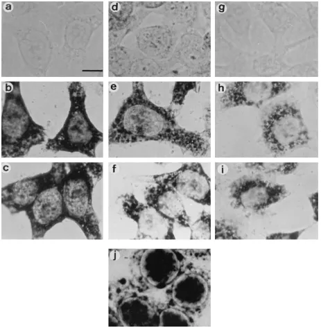 FIG. 4. IE63 is required for the nuclear retention of intron-containing transcripts. Mock-infected HeLa cells (a, d, and g) and cells infected with the IE63 mutantvirus 27-lacZ for 4 h (b, e, and h) and 8 h (c, f, and i) were labelled with antisense riboprobes against IE63 (a to c), IE110 (d to f), or UL15 (g to i), and the hybridized