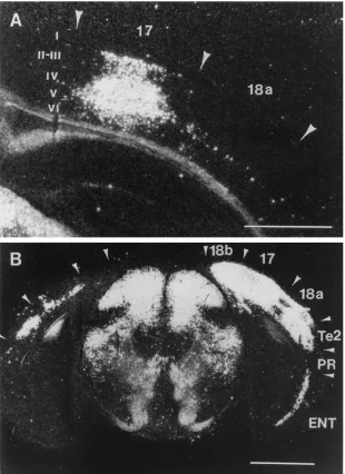 FIG. 5. Dark-ﬁeld micrograph demonstrating infection in the caudal visual cortex and other subcortical and cortical structures