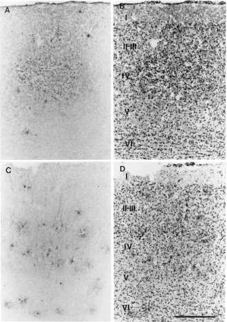 FIG. 7. Different patterns of infection in the primary visual cortex (area 17) following inoculation with HSV-1 strain H129 (A and B) or strain 17 (C and D)