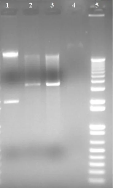 Figure 2:  Preparation of the template DNA to RNA synthesis. The band that ran the slowest corresponds to the linearized plasmid (2 and 3) and the band that ran fastest corresponds to the plasmid in its circular form (1)