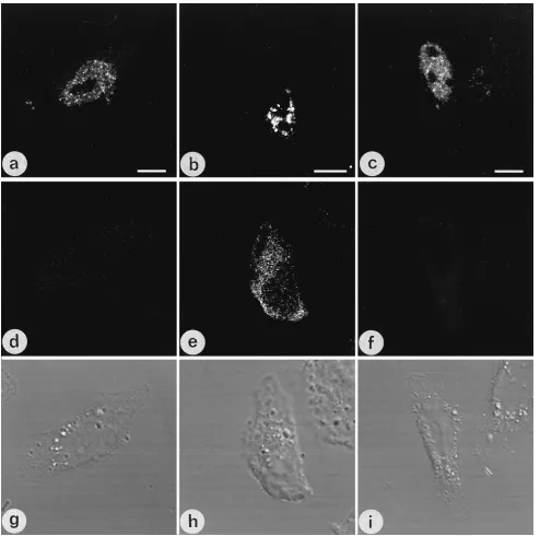 FIG. 12. Rev-independent expression of gagpresent in small granules (a), but no Gag protein was detected by p24 immunostaining (pCMVgag-2 and pCMVgag-2BGi, panels d and f, respectively)