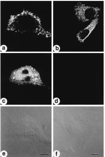 FIG. 2. In situ detection of HIV unspliced HIV mRNA and p24GagNomarski image identiﬁes several nontransfected cells with no detectable p24 immunostaining