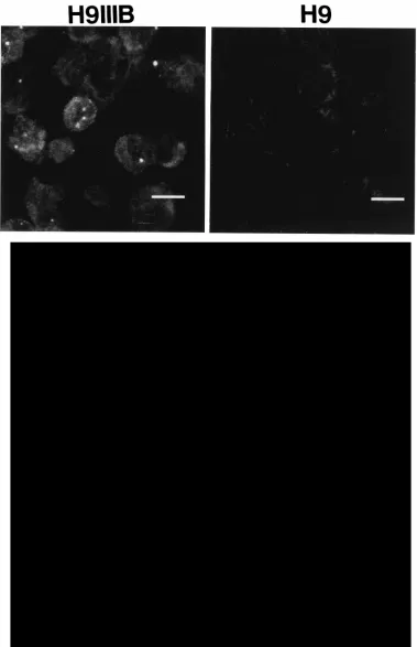 FIG. 4. Detection of HIV unspliced RNA in HIV-infected H9 cells. (Top) H9 cells chronically infected with HIV IIIB or control uninfected H9 cells were cytospunonto microscope slides, ﬁxed, and hybridized in situ to HIV probe B (Fig
