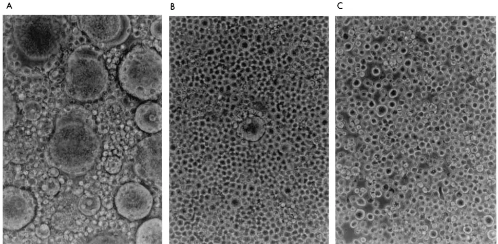 FIG. 6. Quantitative PCR analyses of HIV-1 DNA in cells expressing anti-RT SFv. Various SupT1 lines were infected with cell-free HIV-1cellular DNA was prepared from cells by using a quick lysis procedure (36, 49), and the DNA (1.4pairs SK38-SK39, complemen