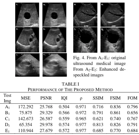 Fig. 4. From A 1-E1: original ultrasound medical image 