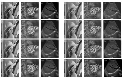 Fig. 5. Comparative performance of the proposed method with other alternative methods  1: Noisy image used in experimentation 2: Wavelet transform combine with wiener filter (M-1)  3: Wavelet transform with hard thresholding (M-2)  4: Wavelet transform with soft thresholding (M-3)  5: Wavelet transform with bilateral filter (M-4)  6: Wavelet transform with total variation filter (M-5)  7: Proposed method (M-6)  