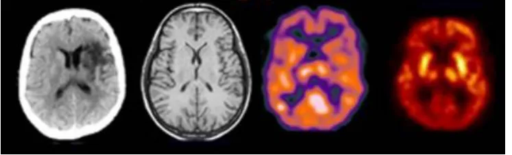 Figure 1.1 Human brain slices with different imaging modalities.  From left to 