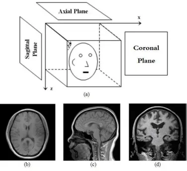 Figure 1.2 MR brain image from patient’s head (a) The setup, (b) Axial plane 