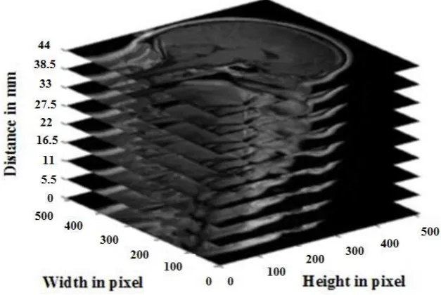 Figure 1.3 MR image sequence (Brown and Semelka 2011) 