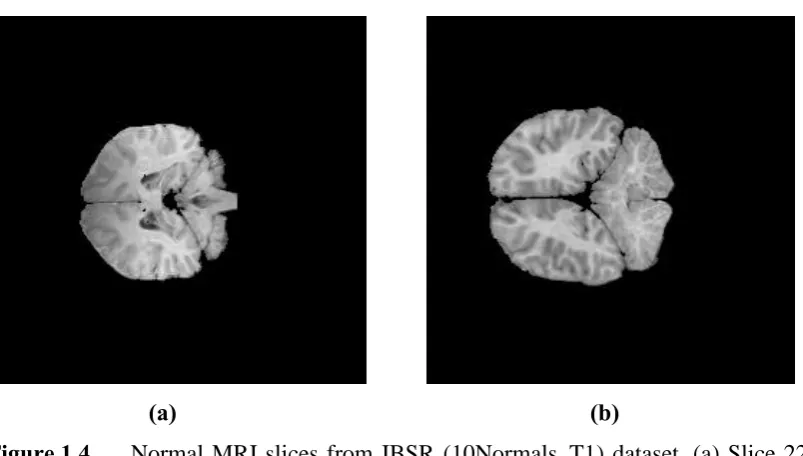Figure 1.4 Normal MRI slices from IBSR (10Normals_T1) dataset, (a) Slice 22 of patient Normal_4, and (b) Slice 16 of patient Normal_15 