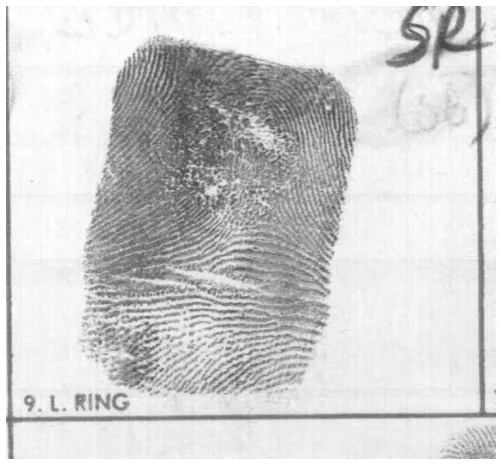 Figure 1.4 An example of a scar fingerprint image (F0002119) found in NIST 
