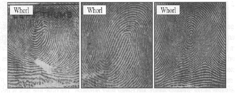 Figure 1.5 Examples of problematic fingerprints found in NIST special Database 