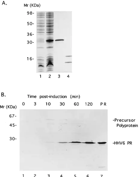 FIG. 3. Expression and puriﬁcation of recombinant HHV-6 and HCMV pro-teinases. Samples were analyzed by SDS-PAGE followed by staining with Coo-