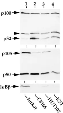 FIG. 1. Expression of IB-like proteins in HTLV-1-infected T cells and non-ogy, Inc.; lower panel)