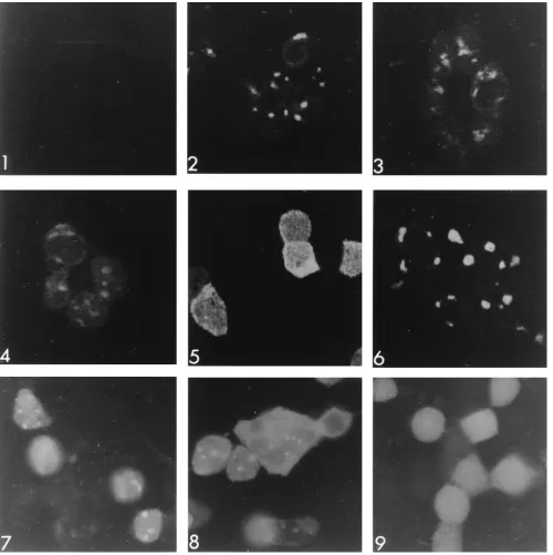 FIG. 7. Intracellular localization of wild-type and US6, mutant D. Panels 7 to 9 show photographic images obtained with a conventional UV ﬂuorescence microscope of 143B cells transfected with GFP plasmids,superinfected with mutant G Uand treated as for Fig