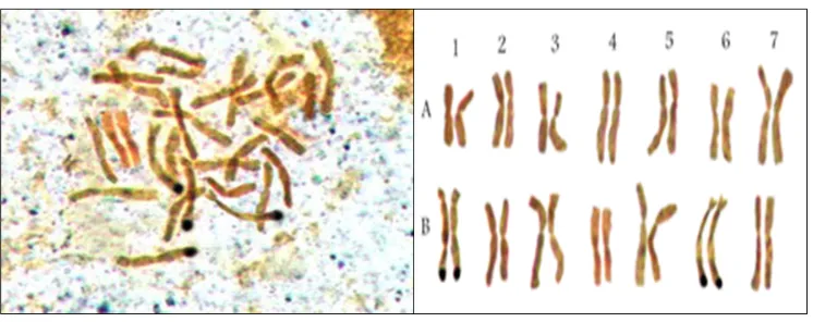 Figure 3. Ag-NOR staining in a tetraploid wheat (T. durum cv. ‘Langdon’). 