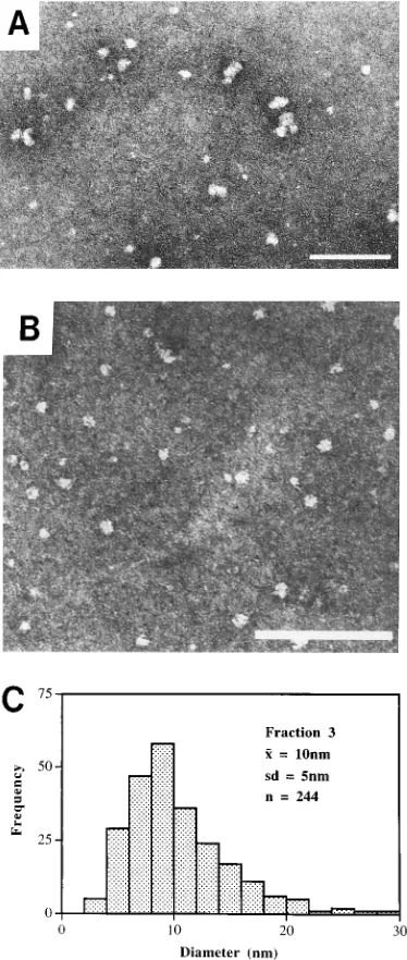 FIG. 4. Electron microscopy of the peak fractions collected from sucrosegradients after centrifugation
