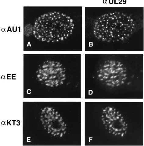 FIG. 1. Cotransfected-superinfected cells doubly labeled with 3-83 andmonoclonal antibodies recognizing epitope-tagged UL5, UL8, and UL52