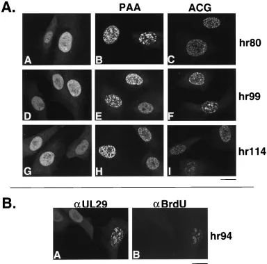 FIG. 3. UL29 localization in cells infected with viral mutants that fail to express UL5, UL8, UL52, or UL9