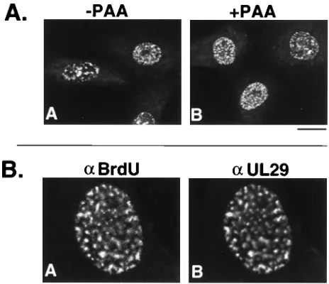 FIG. 5. UL29 localization in cells infected with hrcells were infected with 20 PFU ofcell and processed as described in Materials and Methods