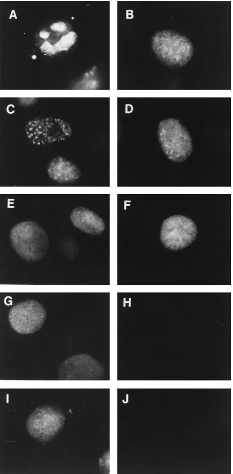 FIG. 5. Distribution of HSV Pol in cells infected with DNA replication-defective mutant viruses