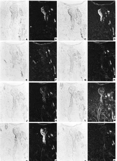 FIG. 3. In situ hybridization of CRPV-infected rabbit skin containing an infected hair follicle exhibiting dysplastic morphological changes