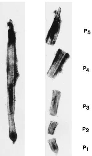 FIG. 7. Morphological aspect of a microdissected rabbit pelage hair follicle.(Left) Pelage guard hair follicle microdissected from a skin biopsy sample taken