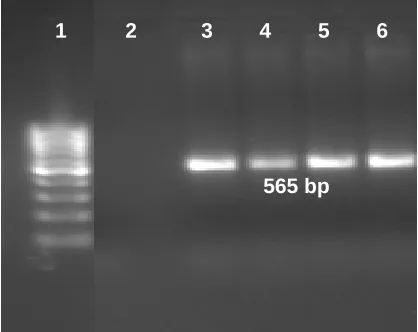 Figure 1. Polymerase Chain Reaction (PCR)  of Transgenic and Control Plants of rice revealing the integration of Bt gene
