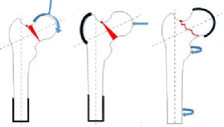 Table 2. As can be seen from the table of results, when metal 