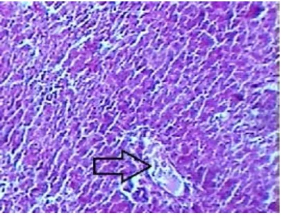 Fig, 1:  Group I (Saline control) – Microscopicfeatures of liver. Normal hepatic study.Hepatocytes and their nuclei are well visible(H& E stain 400x) CV: Central Vein; Arrows:Sinusoids