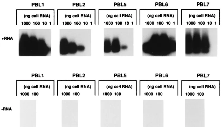FIG. 5. Lack of detection of negative-strand HCV RNA in extrahepatictissues from a chronically HCV-infected chimpanzee