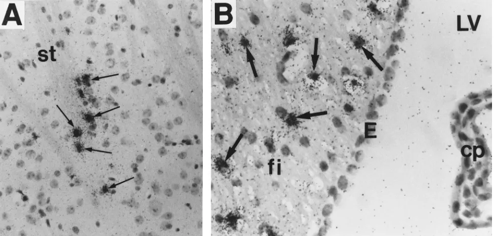 FIG. 3. Distribution of ecotropic MuLV RNA-containing cells (arrows) in grey matter of the brain of an 8-month-old C58 mouse