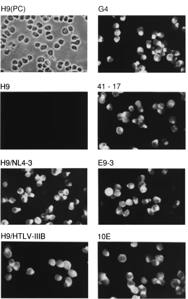 FIG. 2. Intracellular expression of HIV proteins. Harvested cells were permeabilized with Triton X-100 and stained HIVIG, followed by a FITC-conjugatedsecondary antiserum