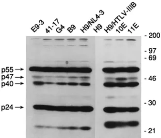 FIG. 3. HIV protein proﬁle. Protein (100 �12.5% polyacrylamide gel and transferred to a nitrocellulose membrane