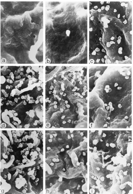 FIG. 4. Production of budding virus. Cells were processed for scanning electron microscopy as described in Materials and Methods and examined on a HitachiS-4500 ﬁeld-scanning electron microscope