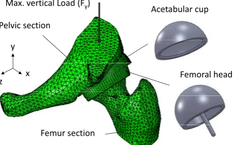 Fig. 3. Segmented hip joint model (model 2) 