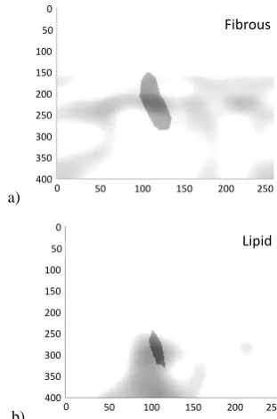 Fig. 7.  Hard-Decision Results from the tissue characterization of the Fibrous (a) and Lipid (b) ROI by using the Histogram-based Model (NH)